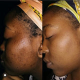 “GLOW THERAPY” Kit